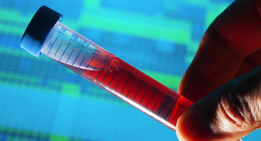Blood test image via Shutterstock.