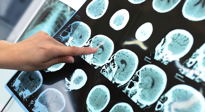 MRI Image via Shutterstock.