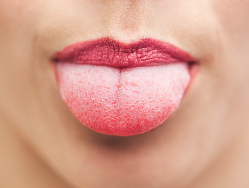 Tongue Photo via Shutterstock.com