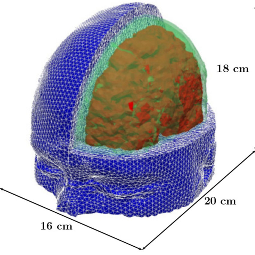 MIT researchers have developed a model of the human head for use in simulations to predict the risk for blast-induced traumatic brain injury. Relevant tissue structures include the skull (green), brain (red), and flesh (blue). Image provided by MIT