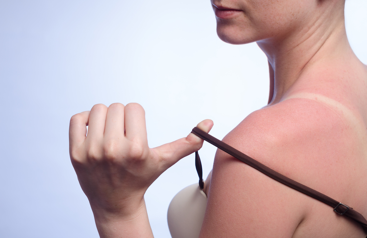 Tanned skin in the sun via Shutterstock