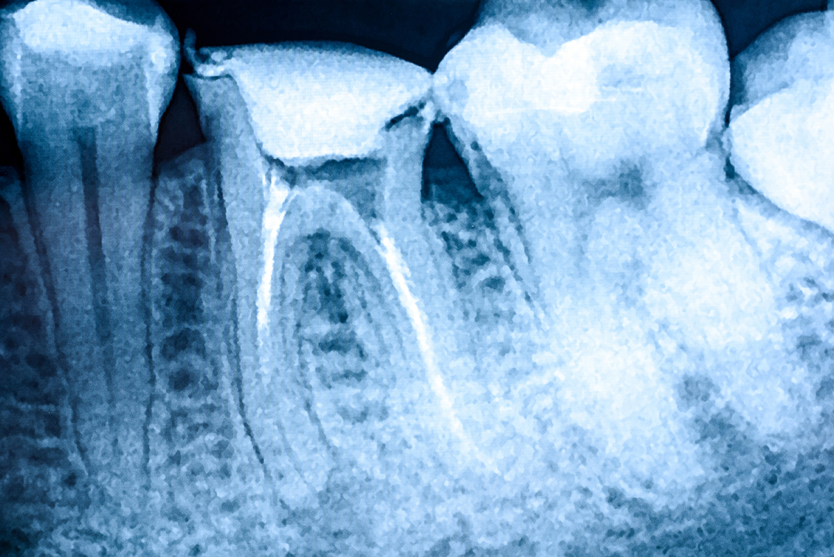 Teeth