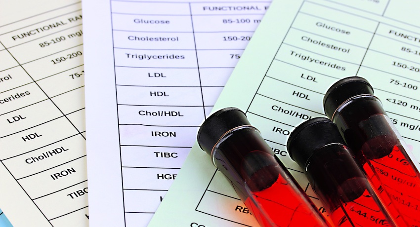 Massachusetts Uses New Version of HIV Test