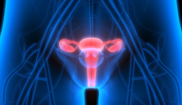 Personalized Screening Improves Early Detection of Deadly Ovarian ...