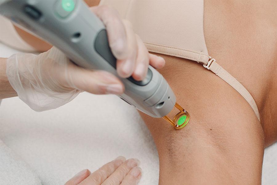 nederlag tusind frokost Everything You Need to Know about Laser Hair Removal in Boston